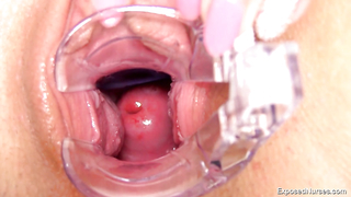 Exposed Nurses eveline dellai 1